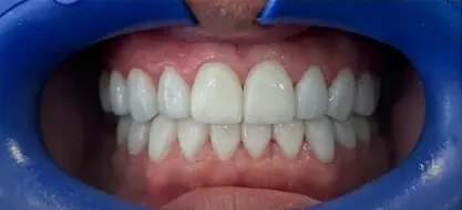 Titus Dental